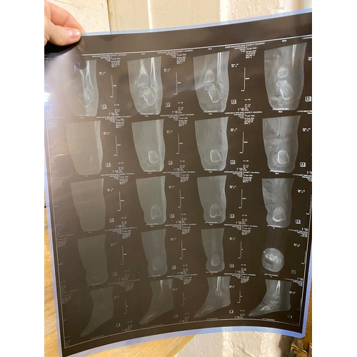 37 - Collection of Abdominal X-Rays and Foot & Ankle CT Scans