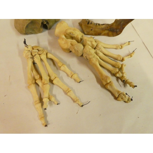 147 - Medical specimens: to include part of a cranium; a jaw; a skeleton hand; and a foot