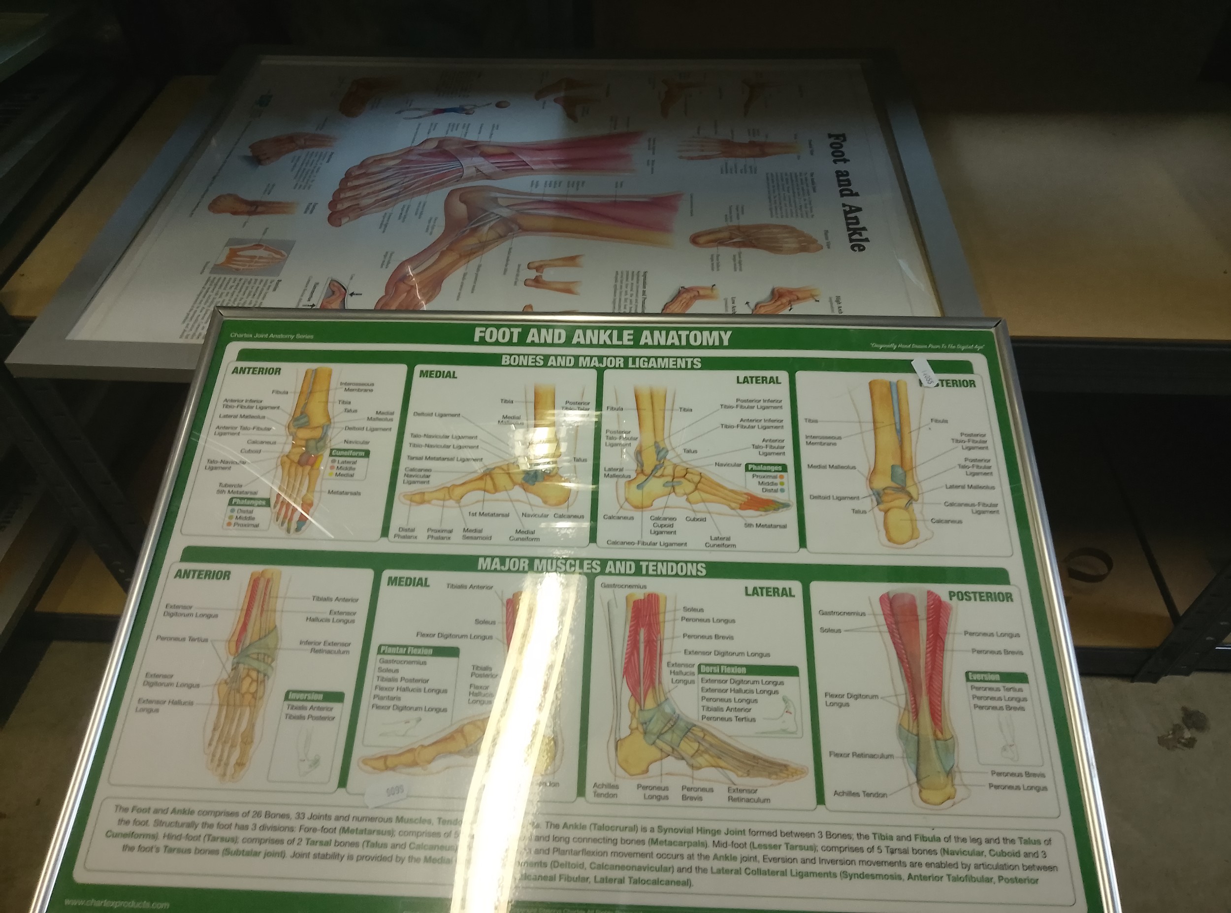 Two framed medical (foot) posters