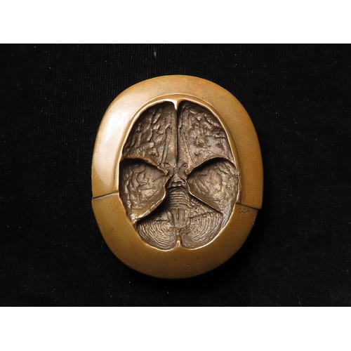 846 - Italian Art Medal / Medical Award, bronze d.84mm: European Course in Neurosurgery, Verona Italy Sept... 