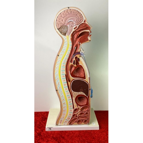 76 - An impressive cross-section of human torso and head with tracheostomy , stands at 73cm. A serious ta... 