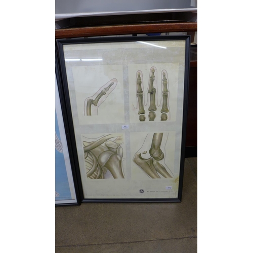 800 - Two framed copies of vintage St Johns Ambulance medical charts