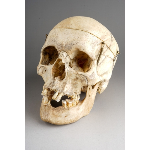 651 - Antique late 19th Century Human Skull.  Anatomical scientific model teaching aid, with sprung jaw an... 