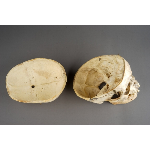 651 - Antique late 19th Century Human Skull.  Anatomical scientific model teaching aid, with sprung jaw an... 