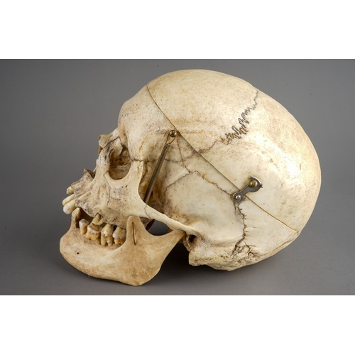 651 - Antique late 19th Century Human Skull.  Anatomical scientific model teaching aid, with sprung jaw an... 