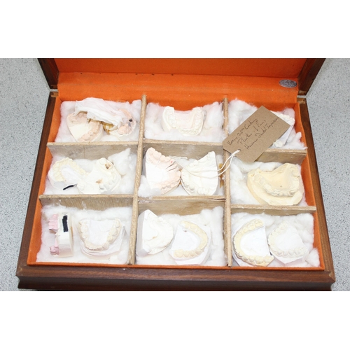 660 - Qty of vintage plaster dental moulds of teeth