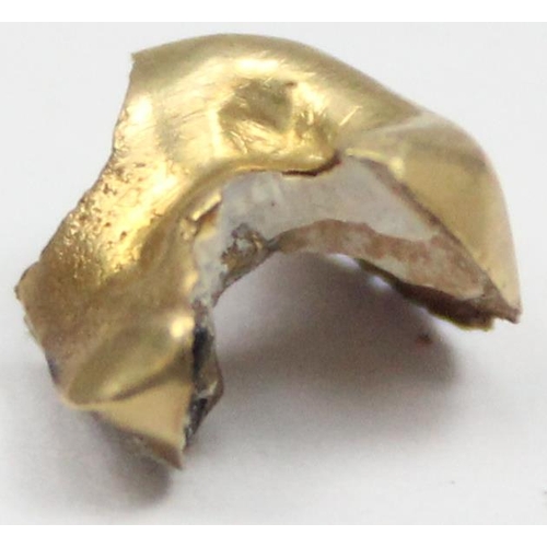 2002 - Gold tooth, XRF tests approx 18ct gold, approx 0.98g gross