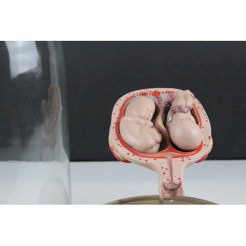 56 - Anatomical Educational Teaching Model of Twin Babies in a Womb contained within a Glass Dome, 39cms ... 