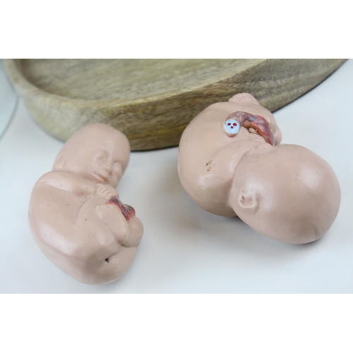 56 - Anatomical Educational Teaching Model of Twin Babies in a Womb contained within a Glass Dome, 39cms ... 