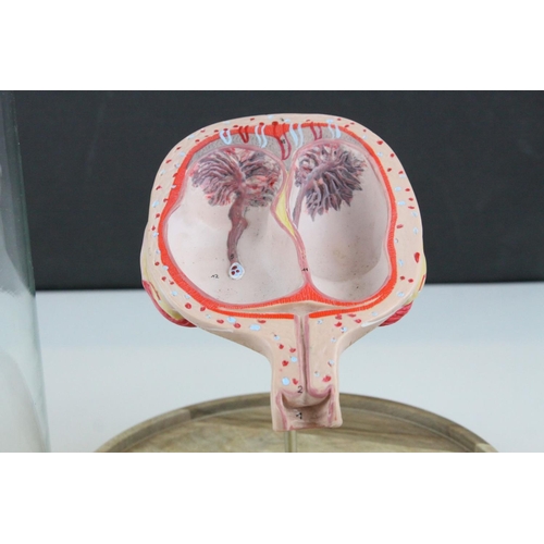 56 - Anatomical Educational Teaching Model of Twin Babies in a Womb contained within a Glass Dome, 39cms ... 