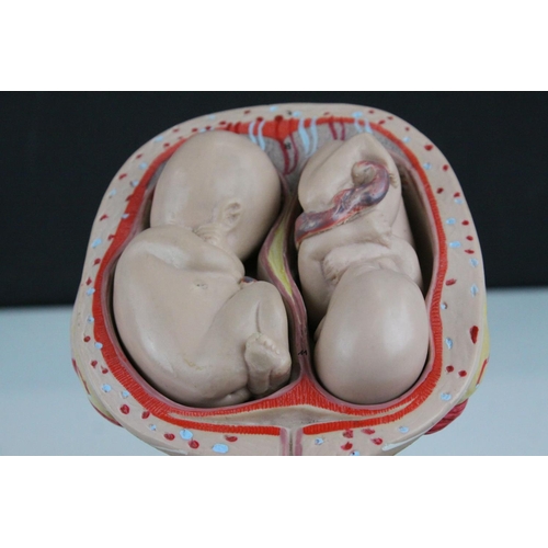 56 - Anatomical Educational Teaching Model of Twin Babies in a Womb contained within a Glass Dome, 39cms ... 