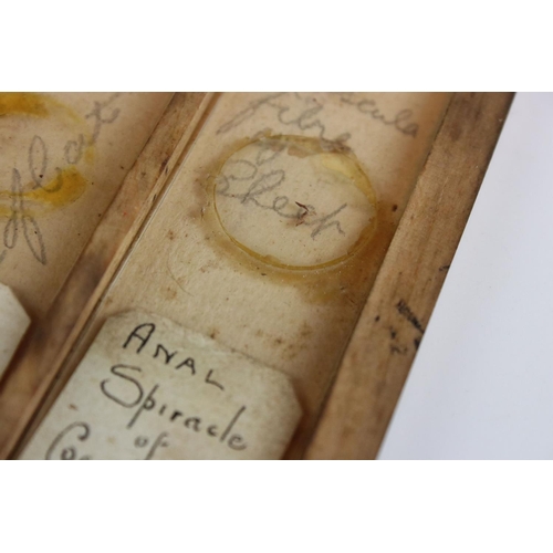 97 - A cased set of antique medical glass slides, slides marked Glasgow Royal Infirmary pathological dept... 