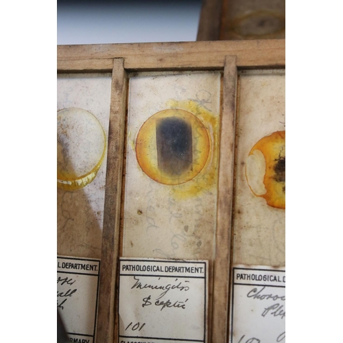 97 - A cased set of antique medical glass slides, slides marked Glasgow Royal Infirmary pathological dept... 