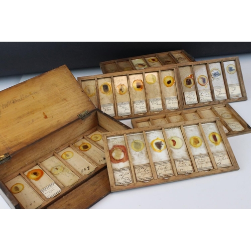 97 - A cased set of antique medical glass slides, slides marked Glasgow Royal Infirmary pathological dept... 