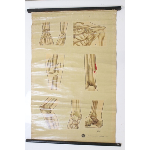 461 - Adam, Rouilly & Company Anatomical Poster of ' First Aid Fracture Chart ' from original drawings by ... 