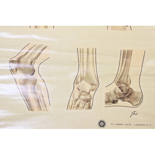 461 - Adam, Rouilly & Company Anatomical Poster of ' First Aid Fracture Chart ' from original drawings by ... 