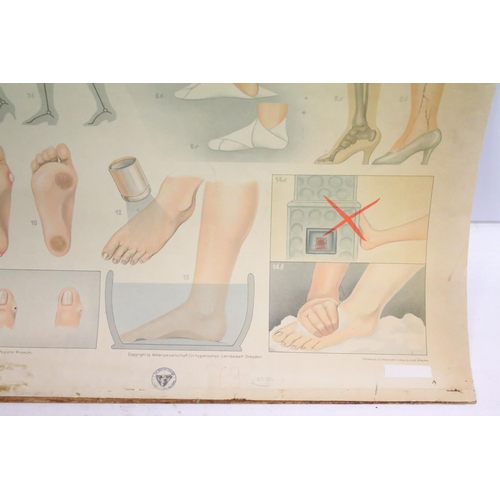 166 - Mid 20th C Deutsches Hygiene Museum 'fußpflege' foot care anatomical / medical poster depicting vari... 