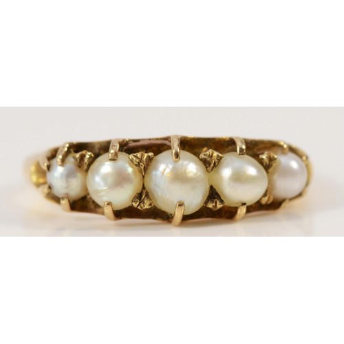 597 - A 14k gold five pearl ring with an 18ct gold repair, K, 2.7g