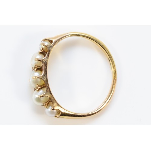 597 - A 14k gold five pearl ring with an 18ct gold repair, K, 2.7g