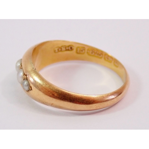 302 - A Victorian 15ct gold ring set five seed pearls, 1.2g, size K