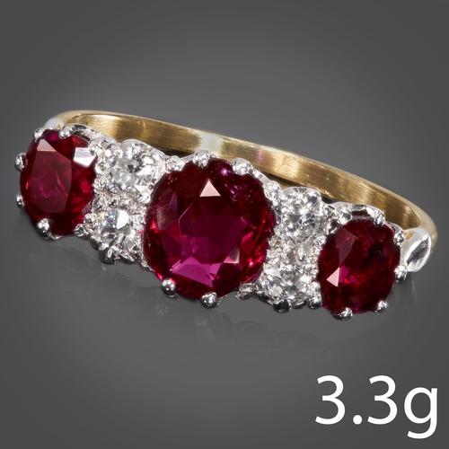 99 - EDWARDIAN RUBY AND DIAMOND RING, 
18 ct. gold. 
Gemstones totalling approx. 1.93 ct.
Set with 3 vibr... 