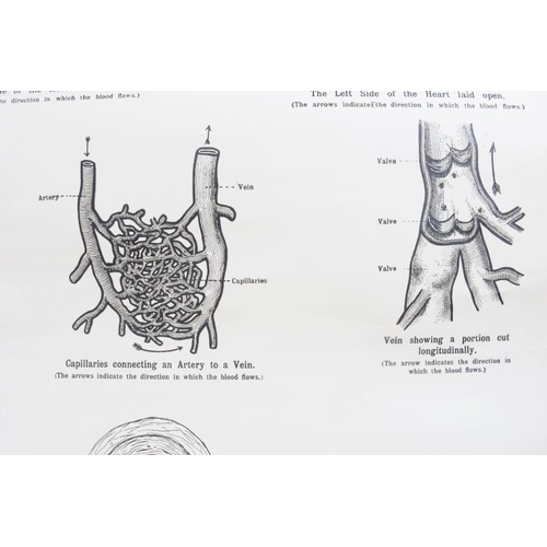 530 - A vintage medical poster, 