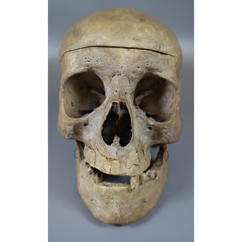 175 - Human Skull.  (B.P. 21% + VAT)