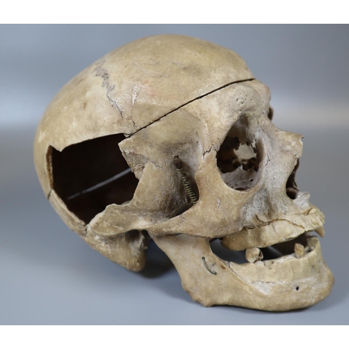 175 - Human Skull.  (B.P. 21% + VAT)