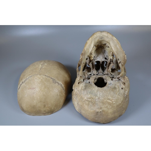 175 - Human Skull.  (B.P. 21% + VAT)