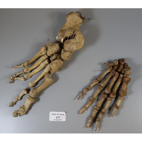 177 - Human Skeletal Hand and Foot.  (B.P. 21% + VAT)