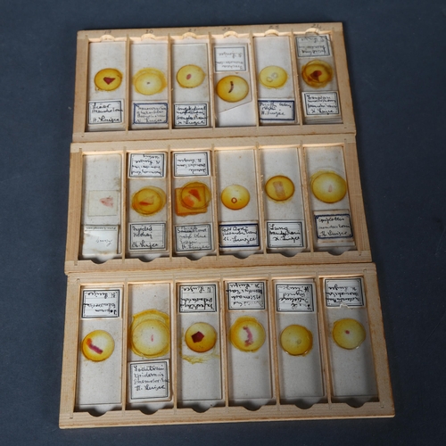 28 - Approximately 75 early 20th Century Human histological microscope slides prepared by the same hand, ... 