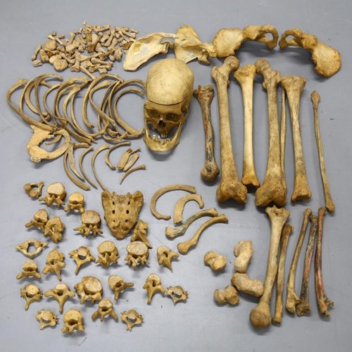 115 - Human Anatomy - A selection of Antique human bones, likely to be a full human skeleton, not articula... 