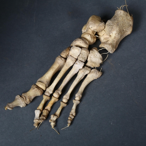 118 - Human Anatomy - An Antique articulated human foot.