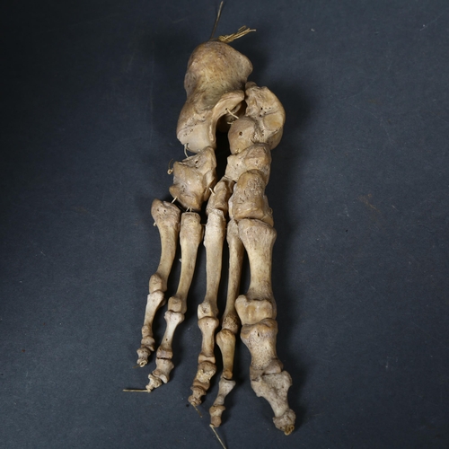 118 - Human Anatomy - An Antique articulated human foot.