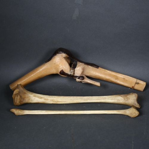 119 - Human Anatomy - A selection of antique human bones, a tibia and fibula, and a 20th century composite... 