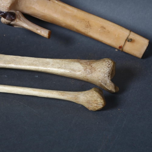 119 - Human Anatomy - A selection of antique human bones, a tibia and fibula, and a 20th century composite... 