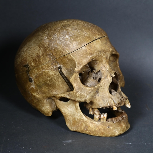 128 - WITHDRAWN - Human Anatomy - An Antique full human skull, with calvarium cut cranium with hook and st... 