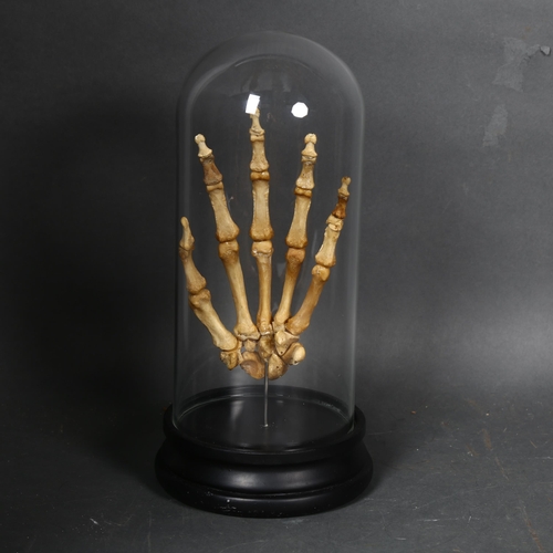 134 - Human Anatomy - a Genuine Human Skeletal Hand in glass dome. The complete bones of a human hand arti... 