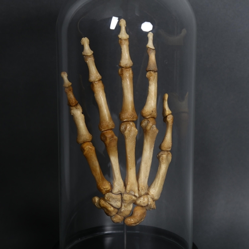 134 - Human Anatomy - a Genuine Human Skeletal Hand in glass dome. The complete bones of a human hand arti... 