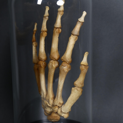 134 - Human Anatomy - a Genuine Human Skeletal Hand in glass dome. The complete bones of a human hand arti... 