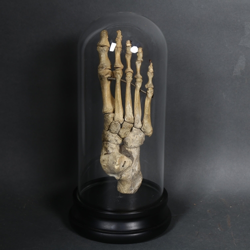 135 - Human Anatomy - a Genuine Human Skeletal Foot in glass dome. The complete bones of a human foot arti... 