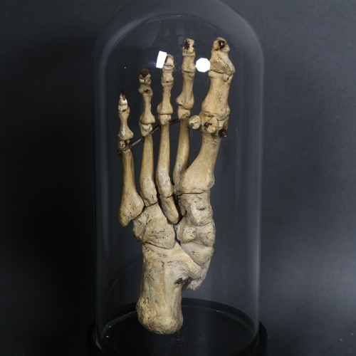 135 - Human Anatomy - a Genuine Human Skeletal Foot in glass dome. The complete bones of a human foot arti... 