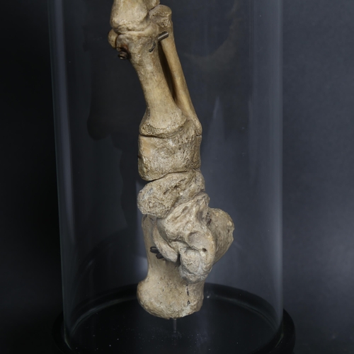 135 - Human Anatomy - a Genuine Human Skeletal Foot in glass dome. The complete bones of a human foot arti... 