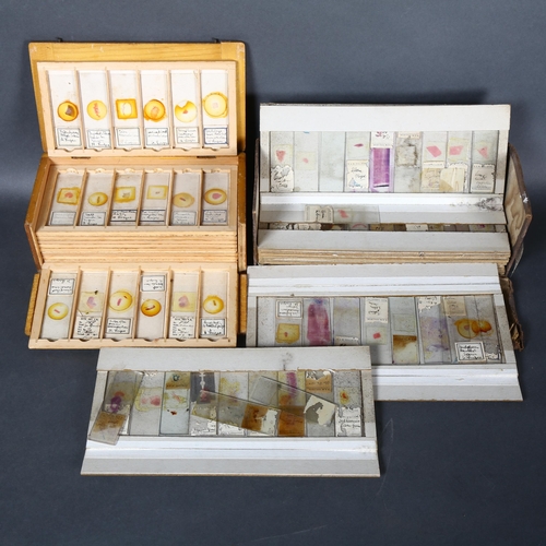 245 - Approximately 75 early 20th Century Human histological microscope slides prepared by the same hand, ... 