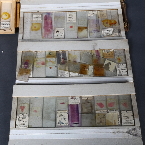 245 - Approximately 75 early 20th Century Human histological microscope slides prepared by the same hand, ... 