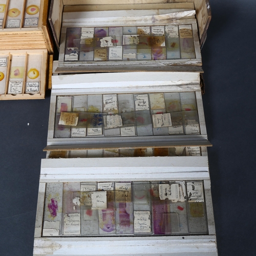 245 - Approximately 75 early 20th Century Human histological microscope slides prepared by the same hand, ... 