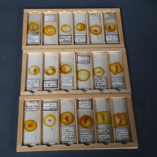 245 - Approximately 75 early 20th Century Human histological microscope slides prepared by the same hand, ... 