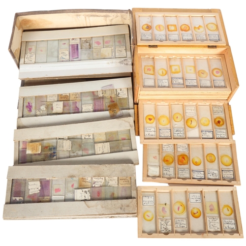 245 - Approximately 75 early 20th Century Human histological microscope slides prepared by the same hand, ... 