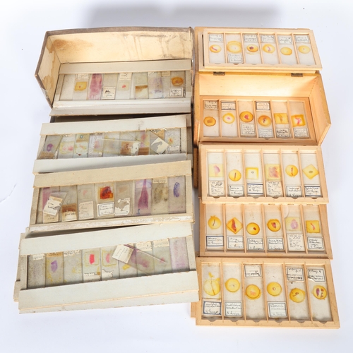 245 - Approximately 75 early 20th Century Human histological microscope slides prepared by the same hand, ... 