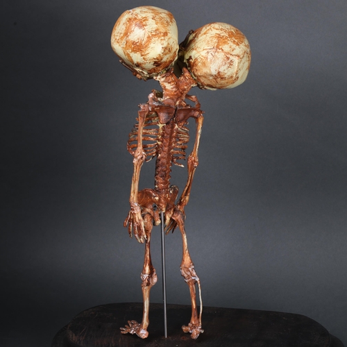 3005 - Curiosity/Macabre : A composite conjoined foetal skeleton, housed under a modern glass dome, height ... 